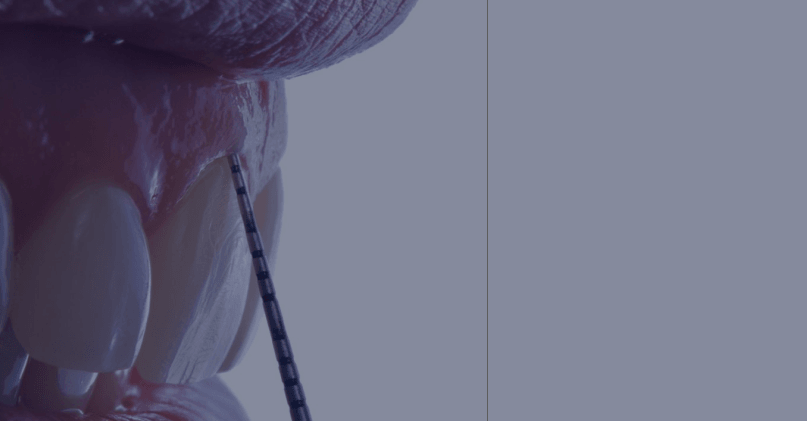 Cosulte<span>datas!</span> Cirurgia Periodontal